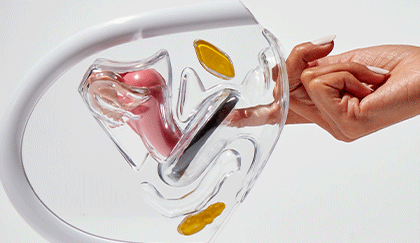 Hand demonstrating menstrual disc removal using transparent anatomical model